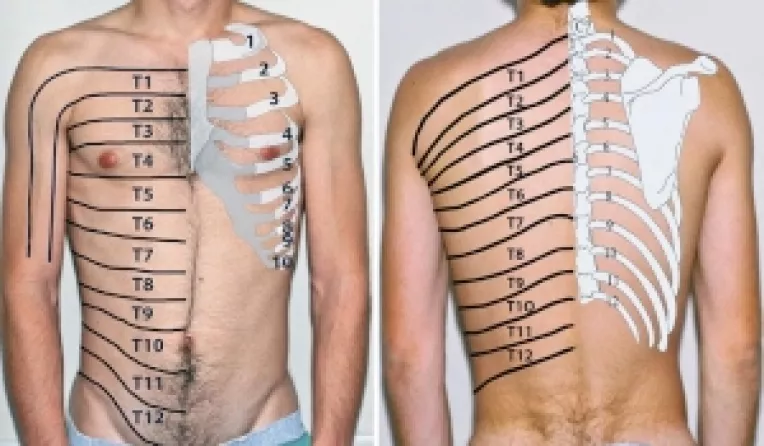 Ce este nevralgia intercostala si cum trebuie tratata