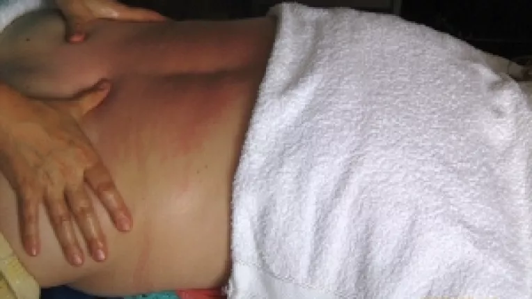 Tratamentul alternativ al afectiunilor oftalmologice